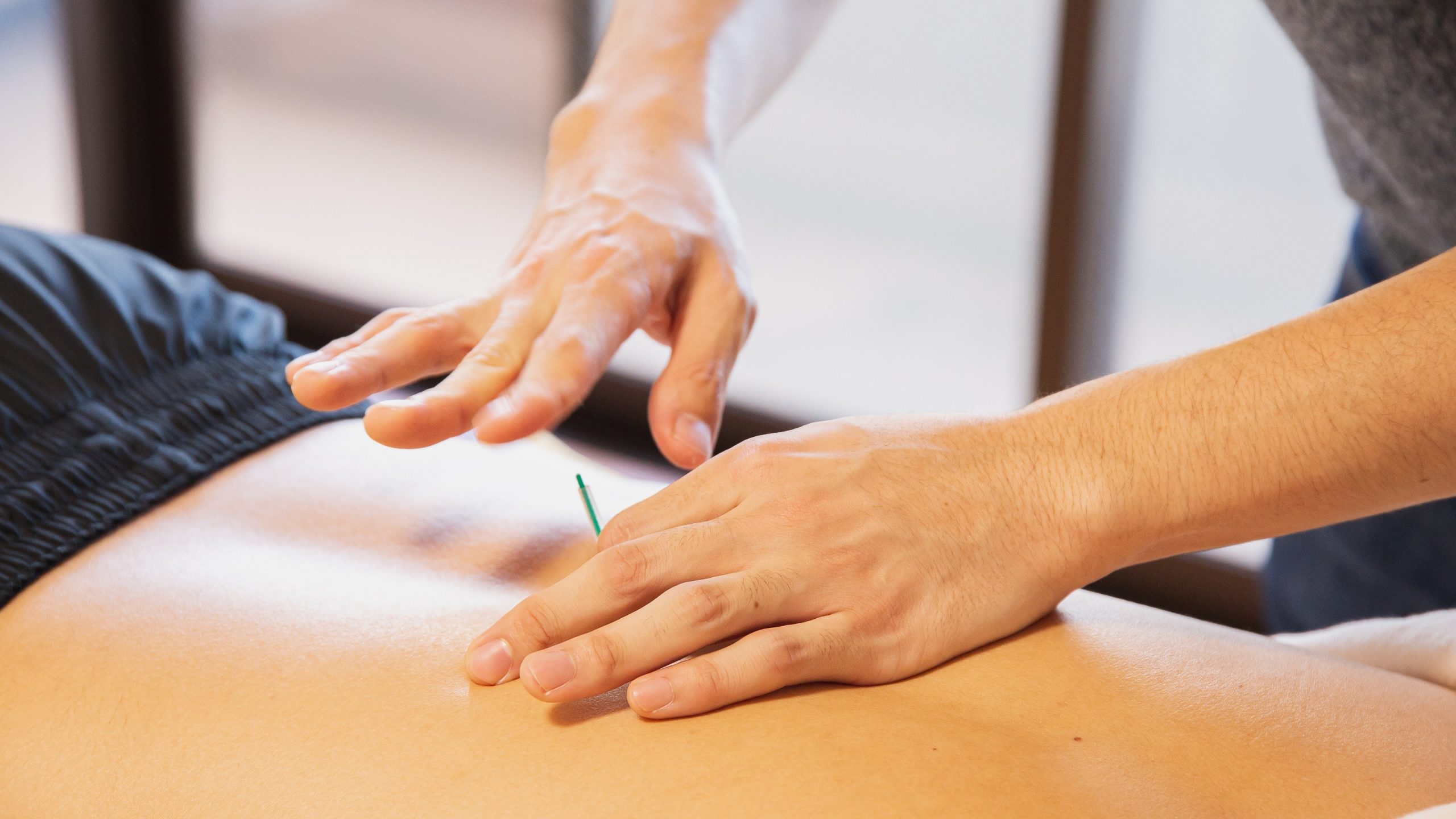 Acupuncture Needles on a Patient